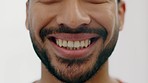 Man, teeth and mouth with invisible braces for insurance dental care, medical wellness or healthcare. Face zoom, smile or happy model before cosmetic tooth surgery or hygiene cleaning for self esteem