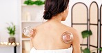 Beauty, wellness and cupping massage on back for physical therapy, healing and ancient medicine. Health, rehabilitation and body treatment for woman customer for relaxation and beautiful skin.

