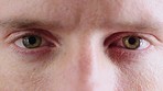 Face macro, eyes and vision of man in optometry examination or medical test for eye care, health and wellness. Zoom, closeup and male eyeballs blink, focus and opening with contact lenses to see.