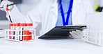 Hands, blood and doctor writing for research, analysis and report for medical study in hospital, lab or clinic. Medic, science and test tube in laboratory with checklist, data and sample for wellness