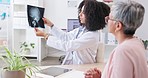 Woman, doctor check and senior woman with mri results in a hospital for brain and head injury. Talking, healthcare and medical worker with elderly female speaking about surgery and treatment choice