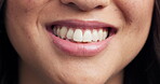 Closeup, mouth and smile of a person for dental health, dentist check or treatment. Zoom, happy and teeth or lips of a woman for braces, medical support or whitening for grooming or showing progress