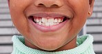 Smile, happy and closeup of mouth of girl in city for happiness, joy and facial expression. Dental care, childhood and face zoom of child for teeth whitening for confidence, pride and oral health