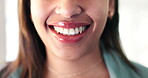 Mouth, teeth or happy and a woman closeup with a smile for dental or oral hygiene to prevent a cavity. Health, whitening and lips with a female patient at the dentist for an appointment or checkup