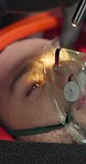 Man, oxygen mask and paramedic with help for accident or injury with danger, closeup or help. Patient, breathing equipment and first responder team with neck brace, emergency and ground in street