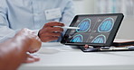 Doctor, hands and tablet with brain scan for patient, consultation or examination results at hospital. Closeup of person, medical employee or nurse pointing to technology for MRI at neurology clinic