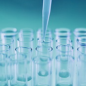 Closeup, drop and test tube in lab with chemical for study, analysis ...