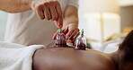 Person, back and cupping therapy as spa treatment for healing or blood flow benefits, drainage or chronic pain. Chiropractor, hands and patient for physiotherapy, inflammation or Chinese medicine