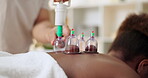 Spa, cupping therapy and back of person for massage treatment, body or muscle pain with vacuum cups. Masseur or therapist, client and skincare with jar for health, wellness and relaxation or rest  