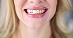 Dentistry, process and woman teeth for before and after with whitening for oral care cosmetics. Happy, smile and female person with mouth for dental hygiene treatment for stain removal versus results