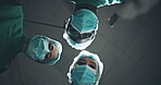 Patient, pov and doctors with surgery in theater with tools, check or help in emergency room with low angle. Surgeon, team and people for collaboration in ppe for safety, hygiene or service at clinic