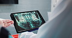 Hands, dentist and tablet screen in healthcare for x ray, teeth diagnosis and plan for treatment. Clinic, patient and dental surgeon with digital for tooth structure, advice and orthodontic procedure