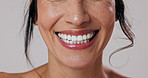 Dental, care and woman with smile for teeth, healthcare and laugh on white studio background. Veneers, excited and model with medical cosmetics for cleaning, mouth and satisfied with wellness results