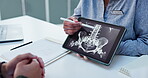 Healthcare, doctor and xray with tablet screen and hands for medical, report or treatment plan. Consultant, medicine or synthetic stem cell therapy with people and bone marrow transplant breakthrough