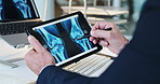 Tablet, screen and hands of man with x ray for assessment, results and healthcare technology at desk. Research, planning and health insurance agent in office with medical scan of legs on digital app