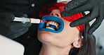 Dentist, patient and hands with syringe for teeth whitening, process and hygiene with healthcare at clinic. Doctor, person and equipment with cheek retractor, cleaning and transformation at hospital
