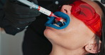 Dentist, person and hands with syringe for teeth whitening, gel or paste for hygiene with healthcare at clinic. Doctor, patient and tools with cheek retractor, cleaning and transformation at hospital