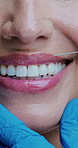 Lip filler, syringe and mouth of woman in studio for plastic surgery, botox and implants for anti aging treatment. Dermatology, skincare and closeup of person smile for cosmetics, beauty or injection