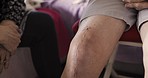 Knee surgery, scar and injury rehabilitation or wound care support for elderly man. Senior person legs, medical acciedent and trauma recovery or orthopedic cardiology therapy at retirement home