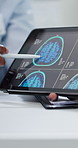 Doctor, hands and tablet screen with brain scan for MRI, examination or x ray results at hospital. Closeup, medical person or neurology with patient or technology display for consultation at clinic