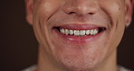 Dental hygiene, smile and man in studio, closeup and fresh breath with confidence on dark background. Results, happiness or person with oral health, aesthetic or pride with teeth whitening or beauty