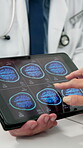 Tablet screen, brain scan and hands of doctor in office for consulting, epilepsy assessment and medical advice. Healthcare feedback, mri results and neurology with people for seizure diagnosis