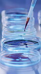 Medical, pipette or person in lab with petri dish, biotechnology or bacteria test for vaccine development. Science, fluid exam or expert with sample, research or analysis in pharmaceutical study.