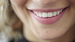 Dental care, mouth and woman with smile at clinic, oral hygiene and teeth whitening results for wellness. Happy, dentistry and person with veneers for orthodontics, tooth implant and fresh breath
