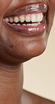 Smile, beauty and dental with lips of woman in studio for oral hygiene, orthodontics and veneers. Self care, happy and teeth whitening with mouth of person on white background for gum health