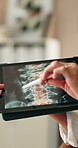 Medical, tablet screen or hands in clinic with x ray, mri result or discussion on patient evaluation. Health, digital or radiologist with stylus, diagnostic feedback or spine scan for treatment plan.