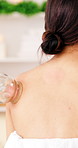 Cupping therapy, back and woman in spa with treatment, pain relief or detox in alternative medicine. Holistic, healing or person with glass, lymphatic drainage or muscle recovery in wellness center.